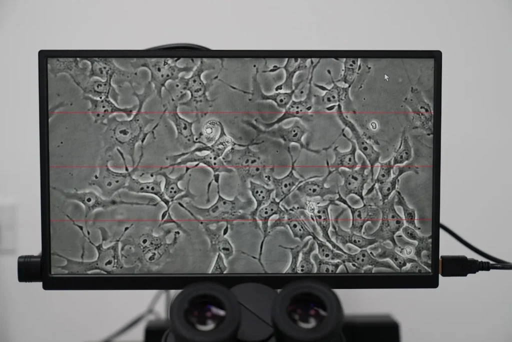 Cultured stem cells for nerve damage research viewed under a microscope at Blast Institute
