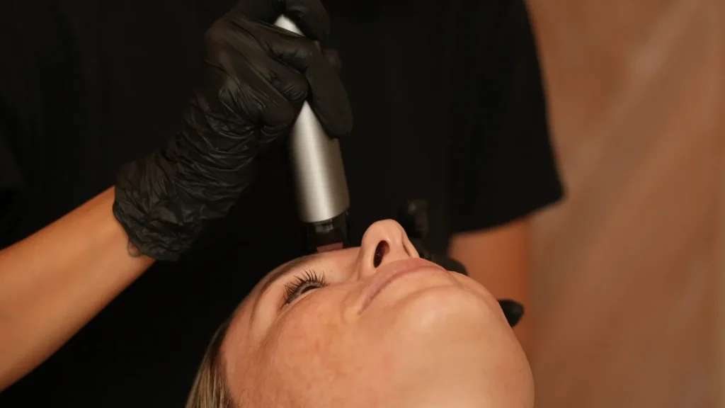 Close-up of a client receiving an exosome facial with a microneedling pen at Blast Institute